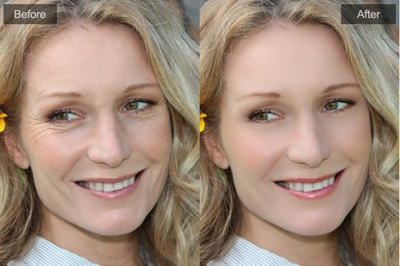 Free Photo Blemish Remover - no-Photoshop retouch